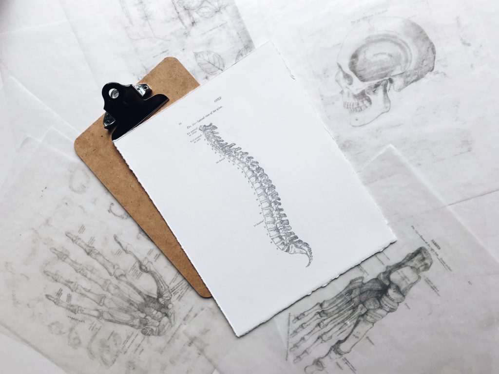Diagram of a spine showing sciatica